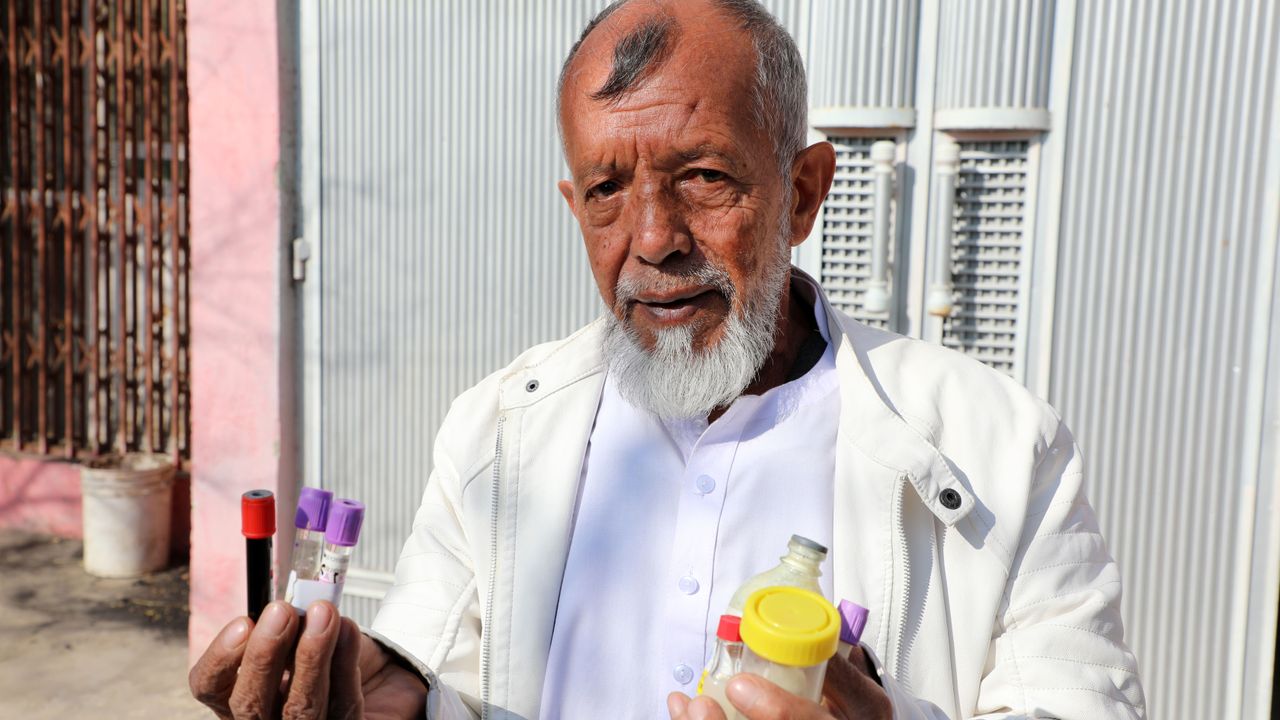 Afgan Doktor, Hastalarını Akrep Zehrinden Yaptığı İlaçlarla Tedavi Ediyor