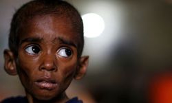 Sudan'da 1200 çocuk yetersiz beslenme nedeniyle yaşamını yitirdi