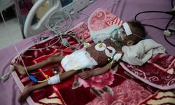 DSÖ: Yemen'de dünyanın en kötü krizlerinden biri yaşanıyor
