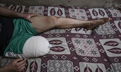 Gazze'deki mahkumların bacakları kelepçe yaralanmaları nedeniyle kesildi