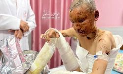 Gazzeli yanık çocuk, ilaç eksikliği nedeniyle acı çekiyor