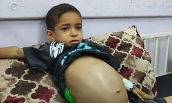 Gazze'de karaciğer ve dalak büyümesi olan 9 yaşındaki Emin, tedavi olamıyor