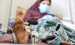 BM: Gazze'de 150 binden fazla hamile kadın, ciddi sağlık riskleriyle karşı karşıya