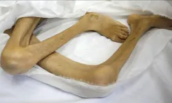 Gazze’de 5 kişi daha açlıktan can verdi