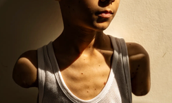 Gazze'de 42 bin kişi hayat boyu bakıma muhtaç