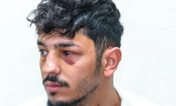 13 İsrailli polis, Filistinli güvenlik görevlisini darp etti