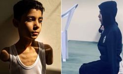 İsrail kollarını kopardı o namazdan kopmadı