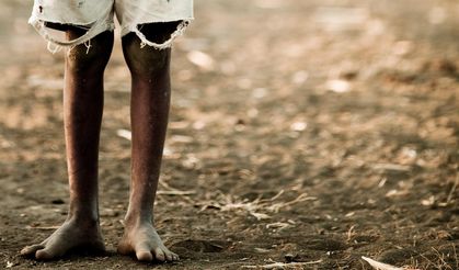 Etiyopya'da Eylül 2023'ten bu yana 860'tan fazla kişi açlıktan öldü