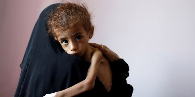UNICEF, Yemen'deki yardımları artırdı