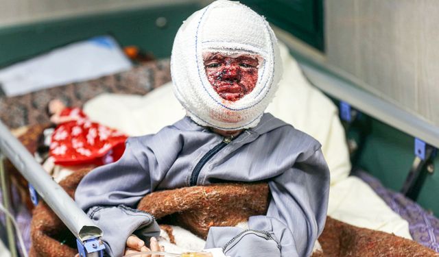 İsrail ordusu, yanık yaraları olan 4 yaşındaki Seca'yı hastanede de rahatsız etti