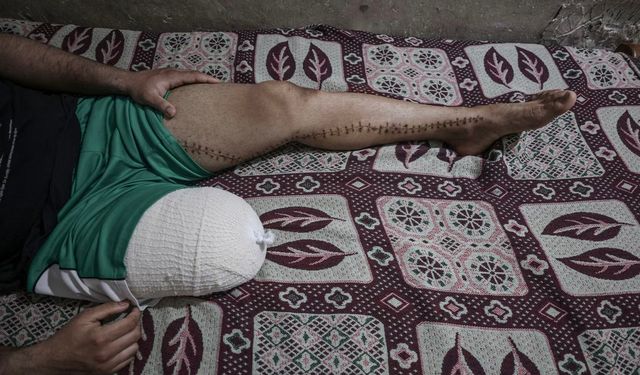 Gazze'deki mahkumların bacakları kelepçe yaralanmaları nedeniyle kesildi
