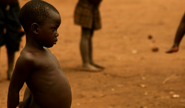 Sudan'da 26 milyon insan akut açlık çekiyor