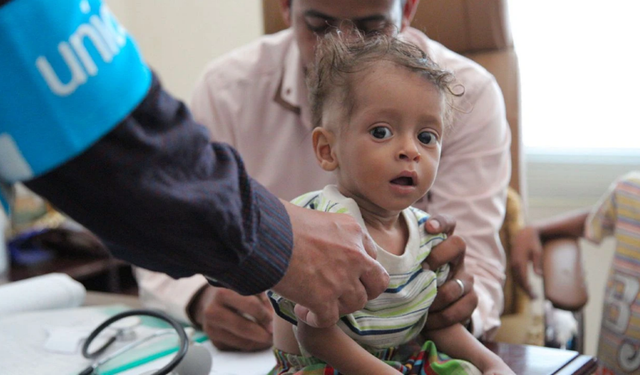 UNICEF: Yemen'de ihtiyaç sahibi ailelere 62,5 milyon dolar yardım ulaştırıldı