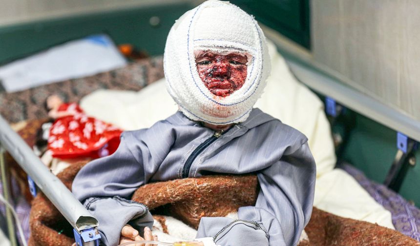 İsrail ordusu, yanık yaraları olan 4 yaşındaki Seca'yı hastanede de rahatsız etti