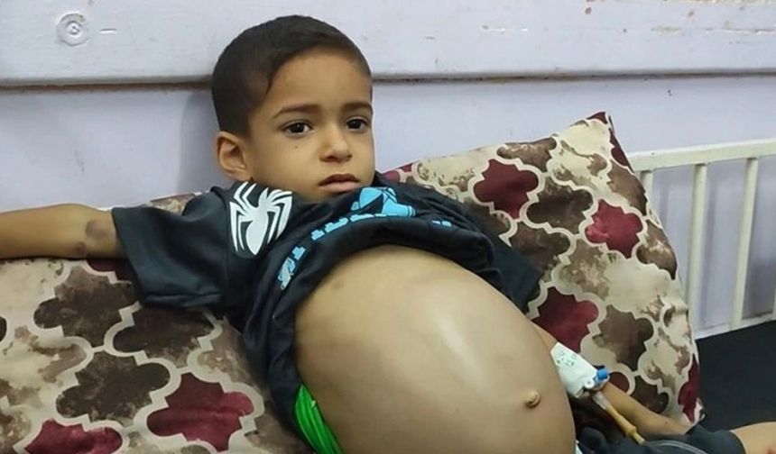Gazze'de karaciğer ve dalak büyümesi olan 9 yaşındaki Emin, tedavi olamıyor