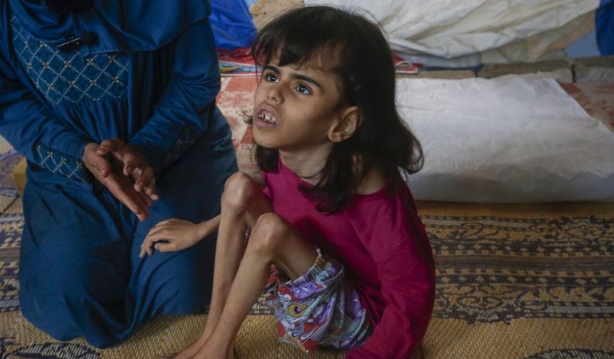 Açlıkla sınanan Gazze’de 11 yaşındaki Dana yaşam mücadelesi veriyor